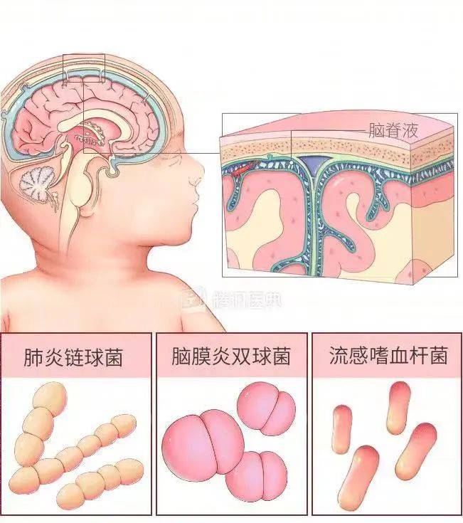 狐大医 | 从前夫家“抢”回女儿后，“我发现她的脑子在漏水！”