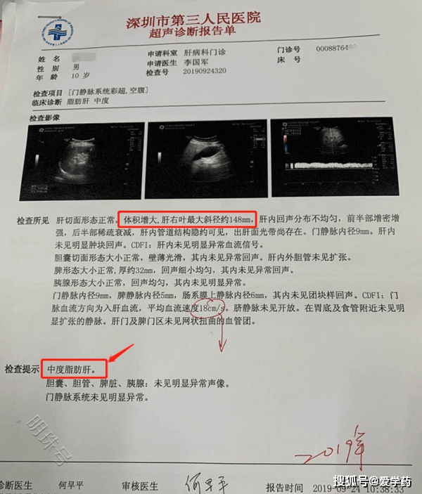 这些事请比熬夜还伤肝，别再做了！看看你做过没